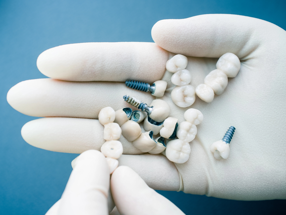 implant dentistry
